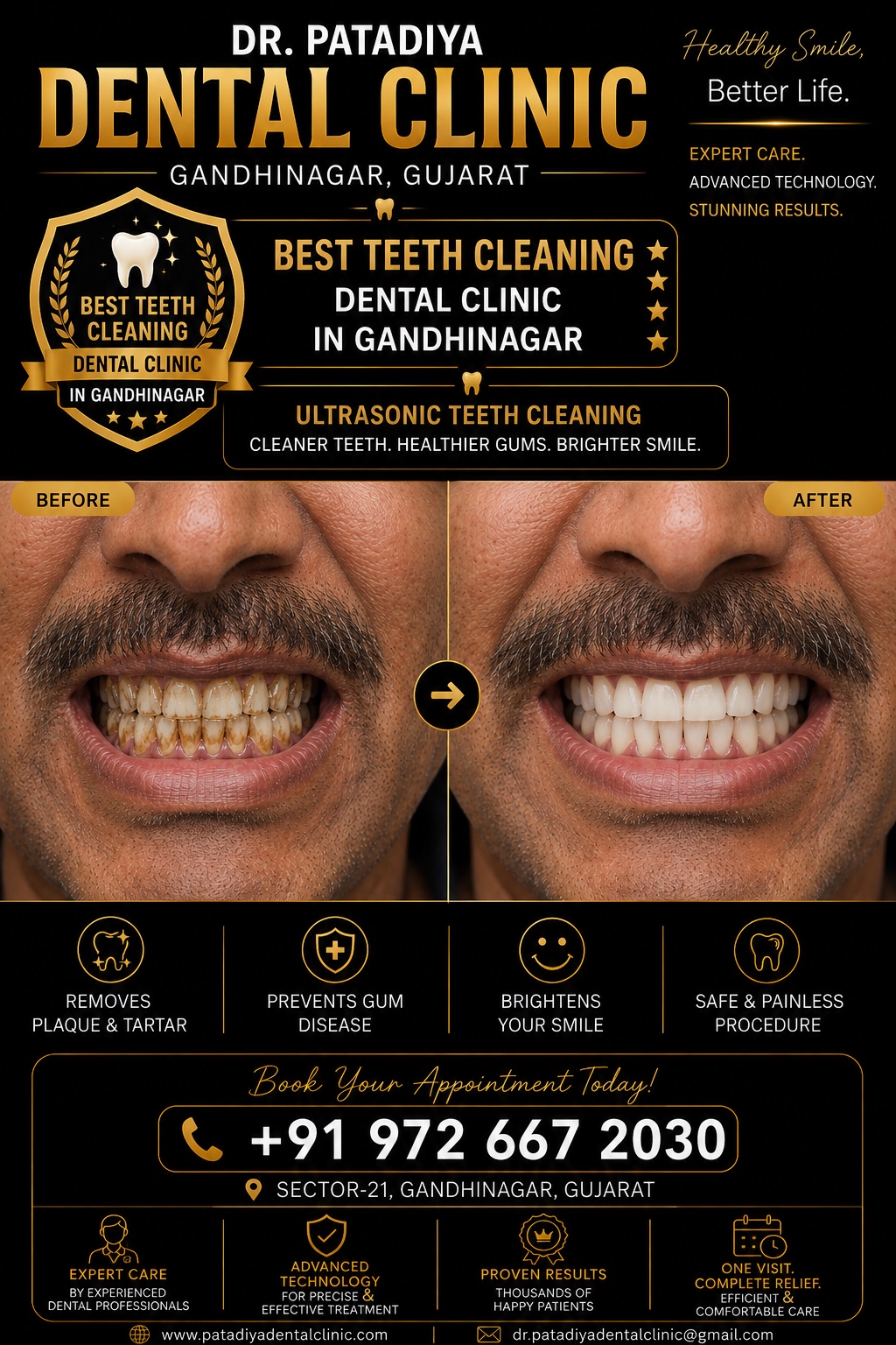 Teeth Cleaning and Polishing before and after poster – Dr. Patadiya Dental Clinic Gandhinagar
