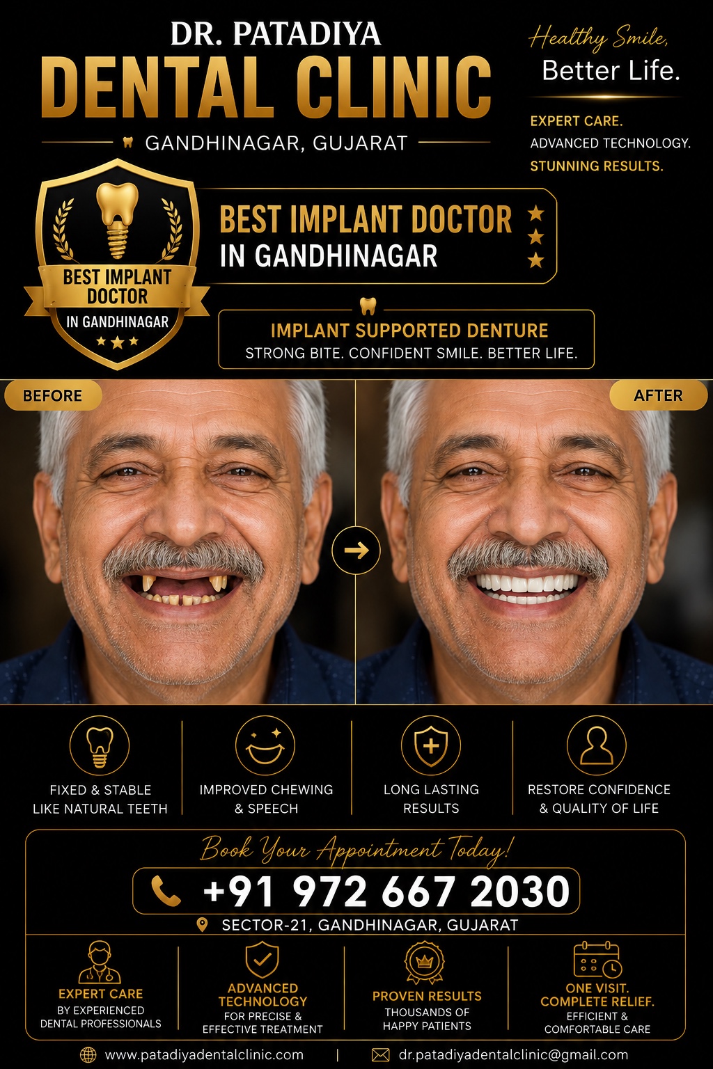 Implant Supported Denture before and after poster – Dr. Patadiya Dental Clinic Gandhinagar