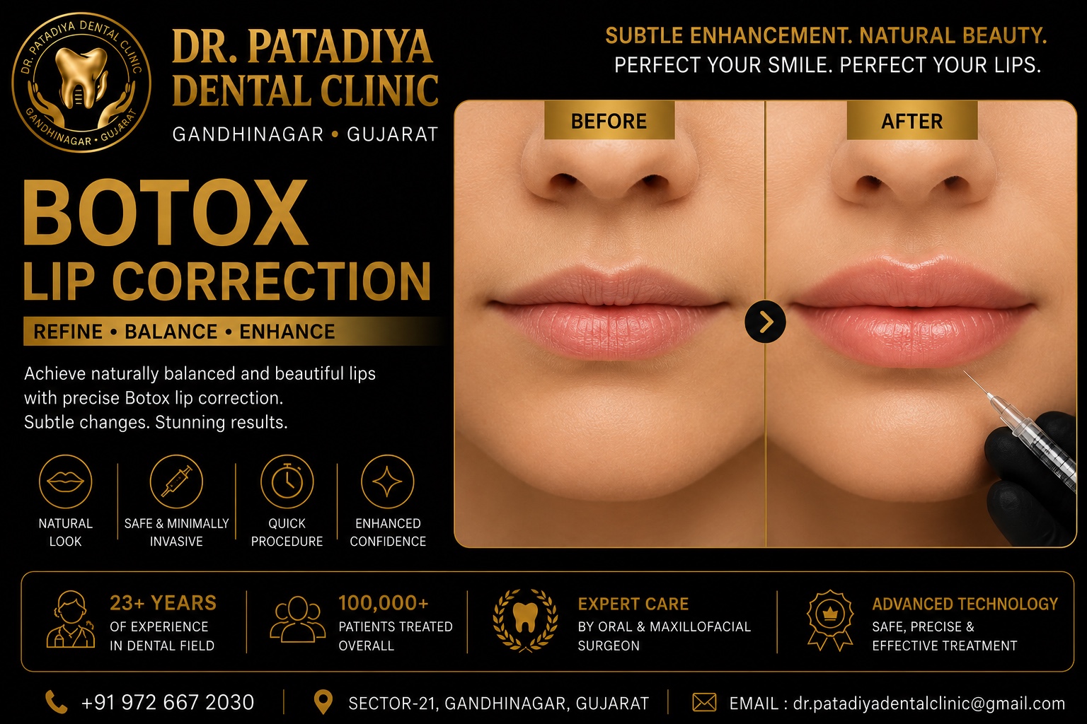 Botox Lip Correction – Dr. Patadiya Dental Clinic Gandhinagar