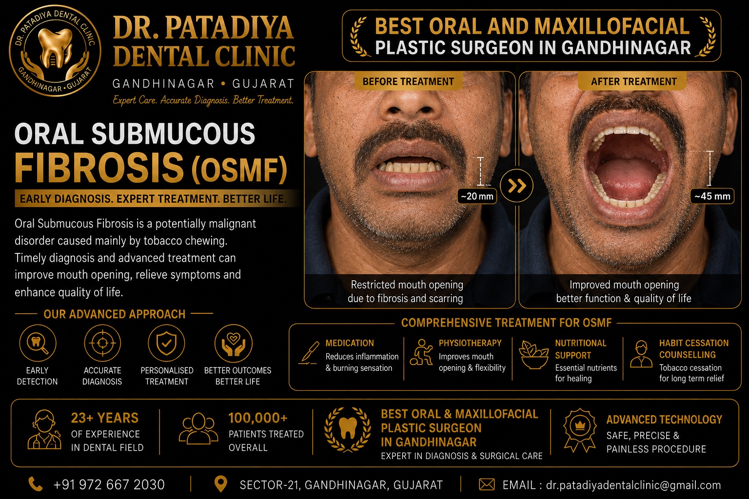 Mouth Opening Treatment – Dr. Patadiya Dental Clinic Gandhinagar
