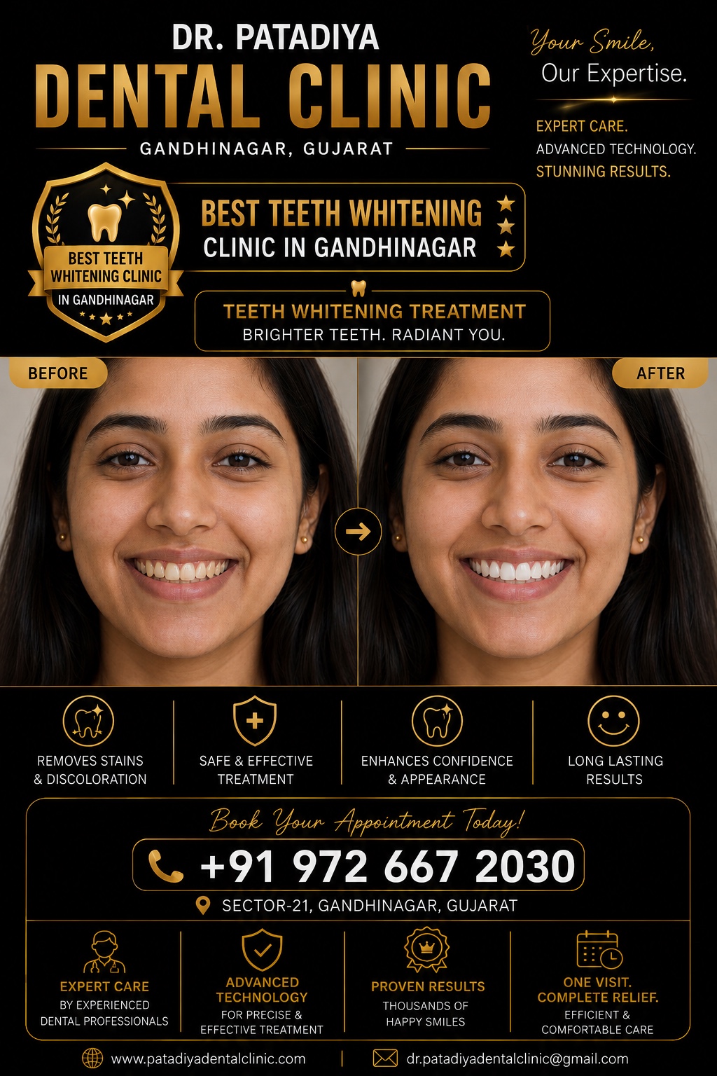 Best Teeth Whitening Clinic in Gandhinagar – Dr. Patadiya Dental Clinic