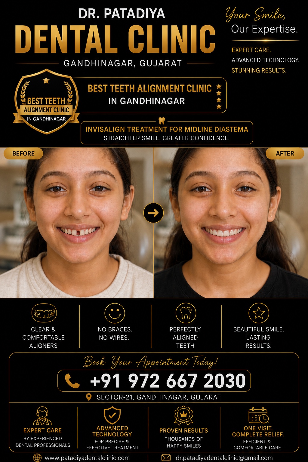 Best Teeth Alignment Clinic in Gandhinagar