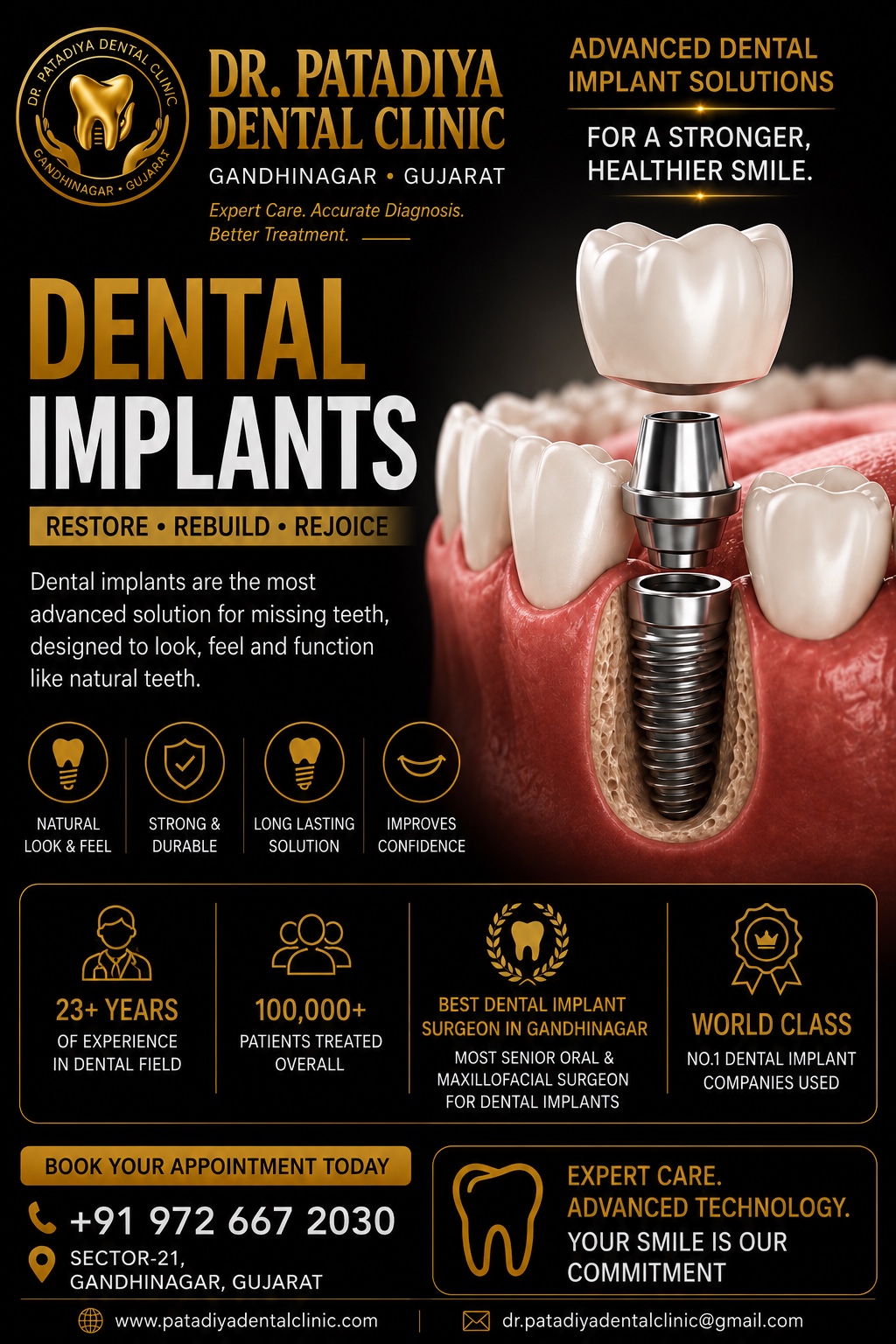 Dental Implants – Dr. Patadiya Dental Clinic Gandhinagar