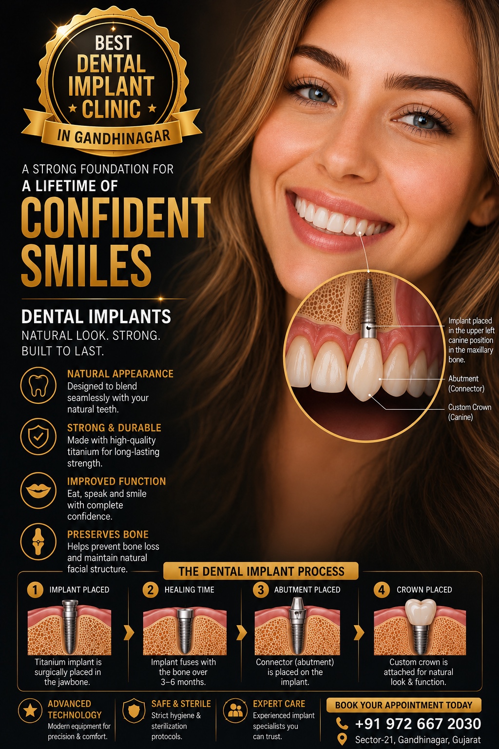 Best Dental Implant Clinic in Gandhinagar