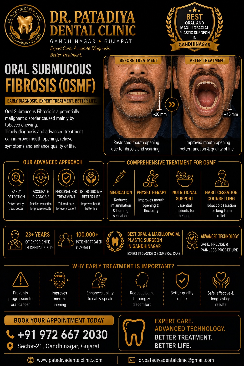 Oral Submucous Fibrosis OSMF treatment information at Dr. Patadiya Dental Clinic Gandhinagar