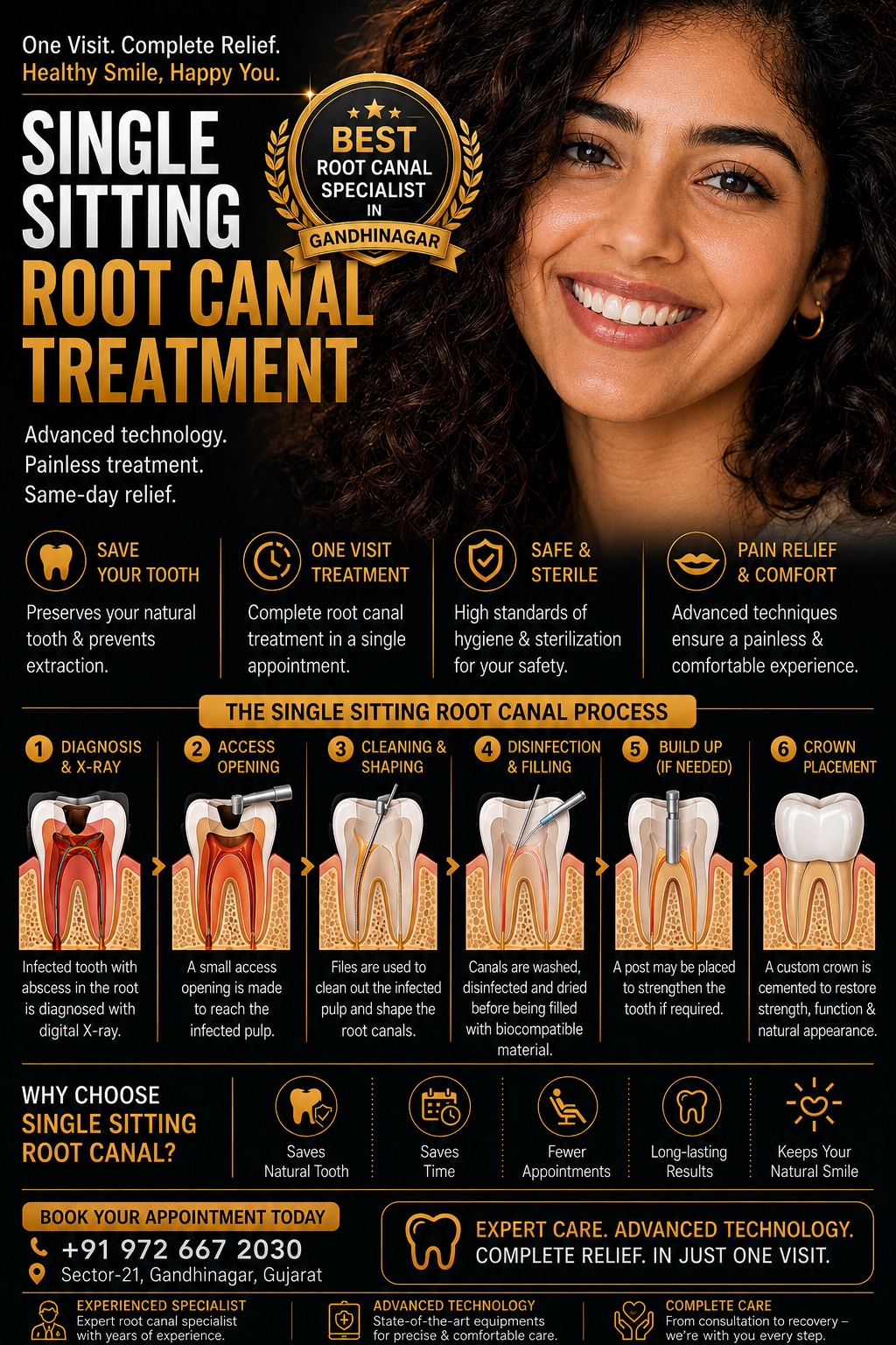 Single Sitting Root Canal Treatment – patient education poster