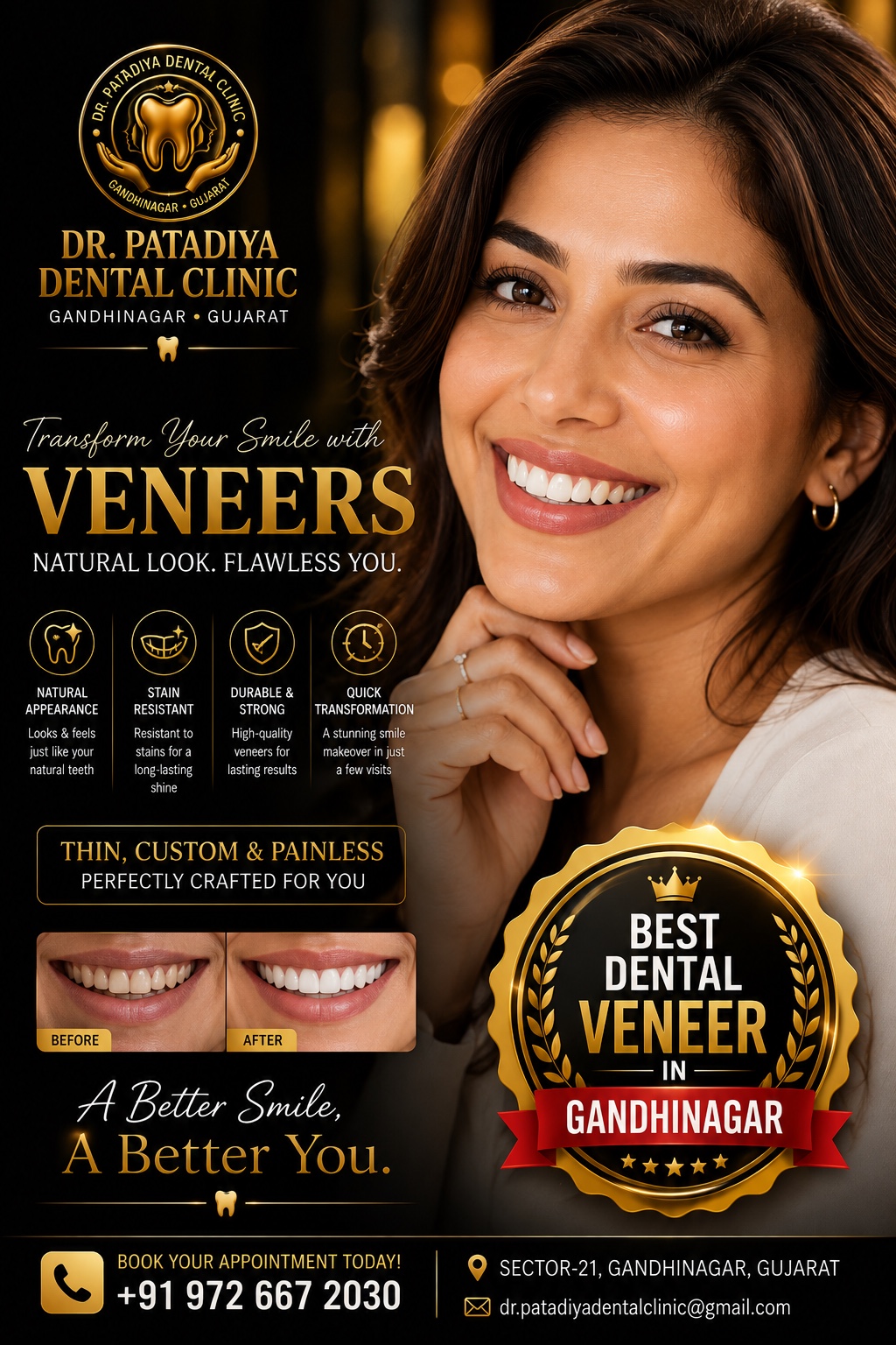 Dental veneers smile transformation information at Dr. Patadiya Dental Clinic Gandhinagar