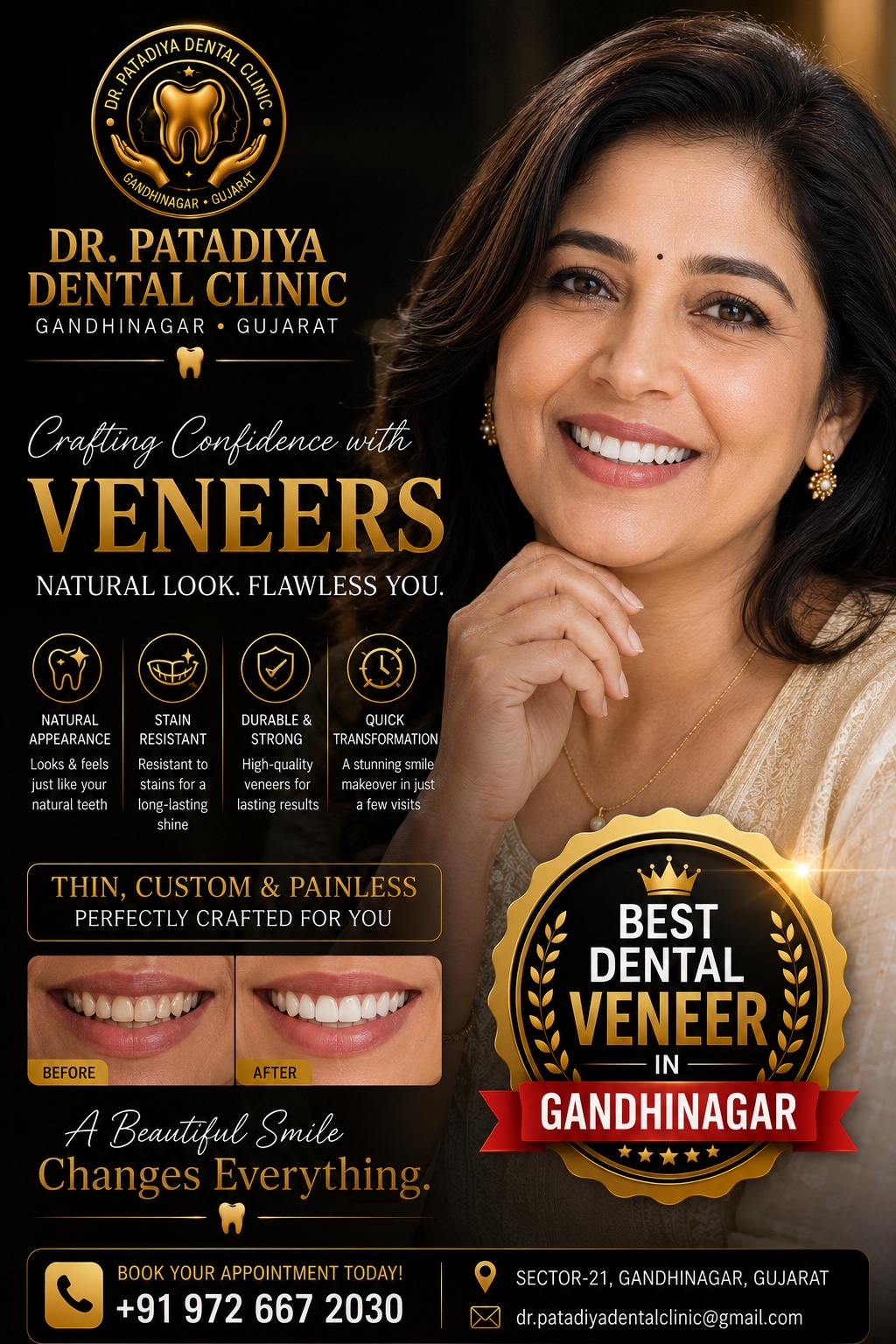 Dental veneers cosmetic dentistry information at Dr. Patadiya Dental Clinic Gandhinagar
